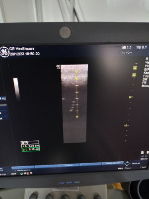 Ультразвуковой сканер logiq C5 Premium